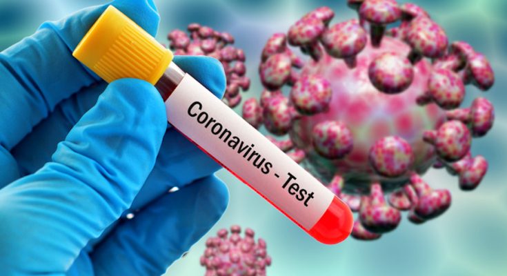 Coronavirus-test5-735x400