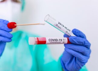 Cosenza: caso test sierologici e tamponi in frigo: Movimento NOI: bene intervento della Magistratura