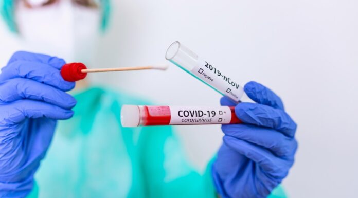 Cosenza: caso test sierologici e tamponi in frigo: Movimento NOI: bene intervento della Magistratura